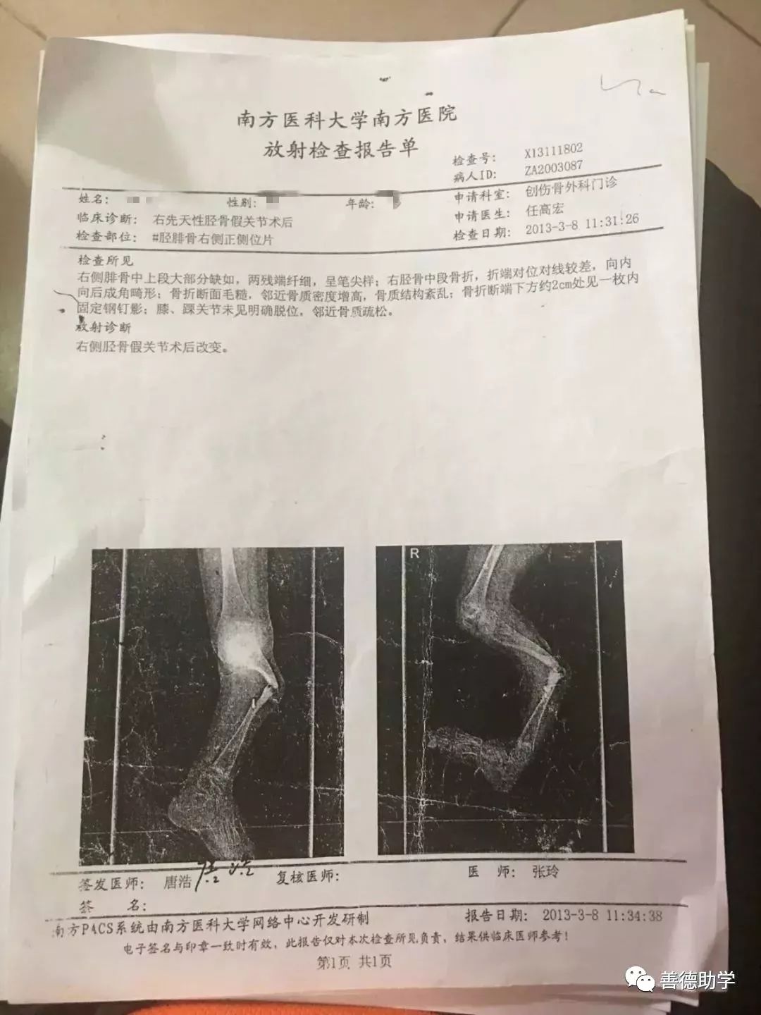 以上为小龙检查报告